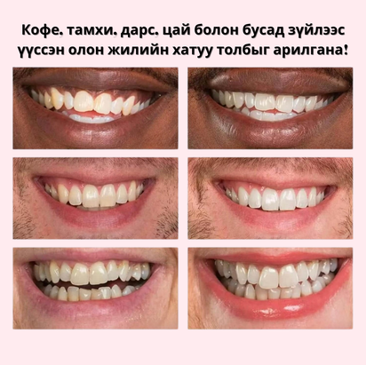 Шүд Цайруулах Kit