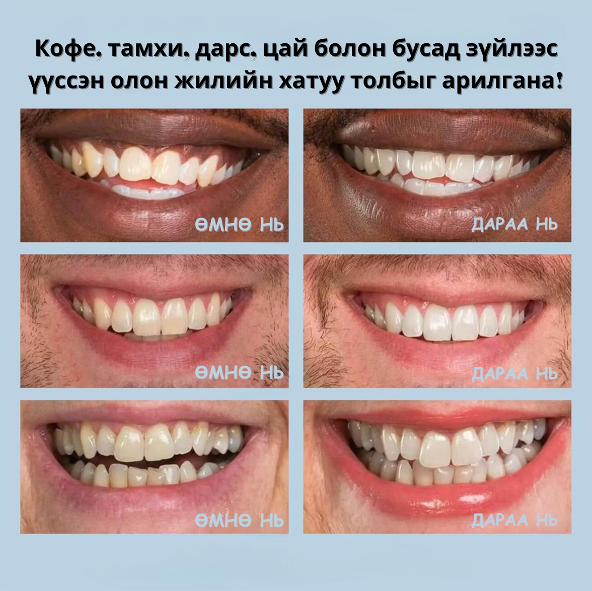 Шүд Цайруулах Kit